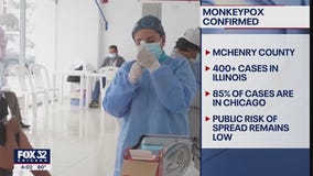 First confirmed case of monkeypox in McHenry County reported, health officials say