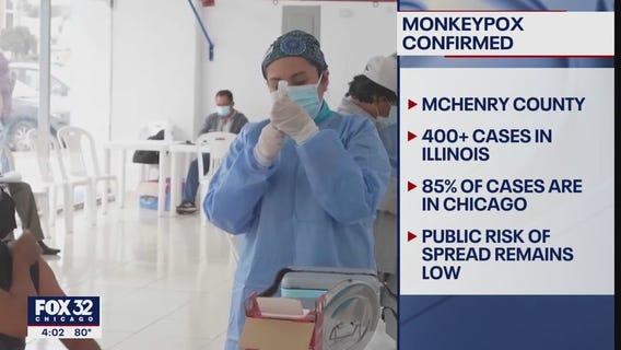 First confirmed case of monkeypox in McHenry County reported, health officials say