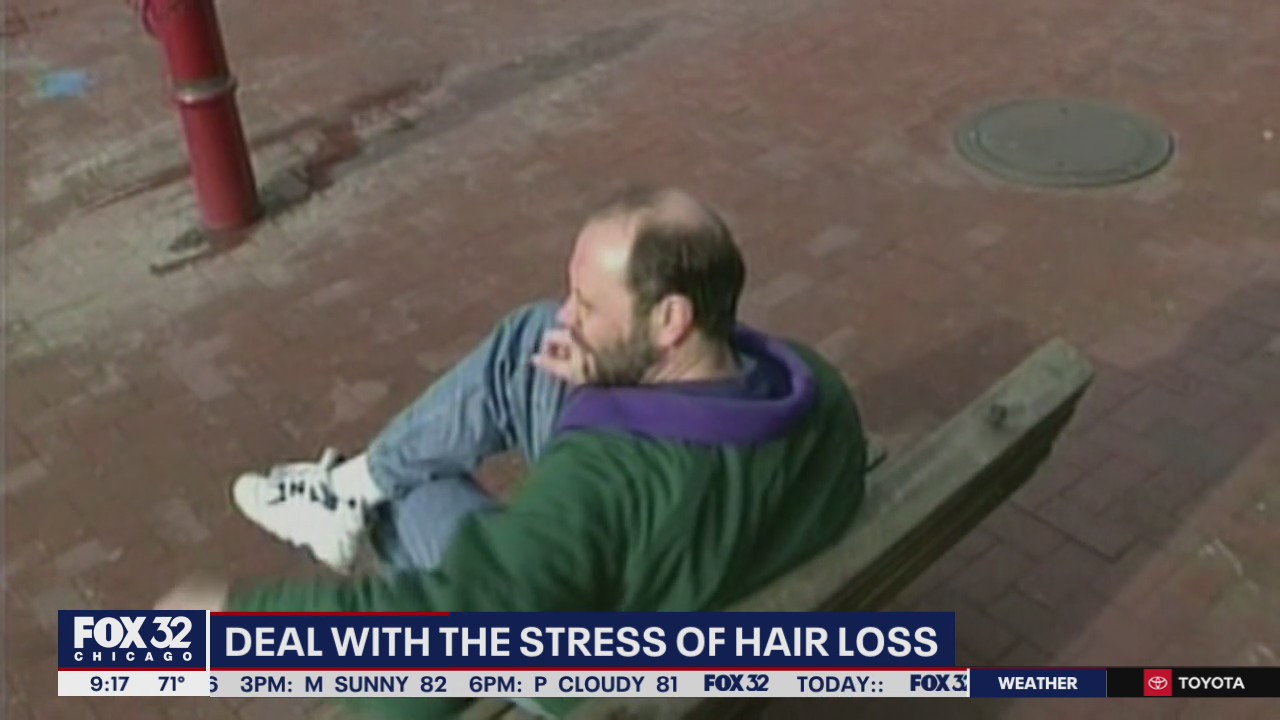 What causes hair loss and what is the best form of treatment?