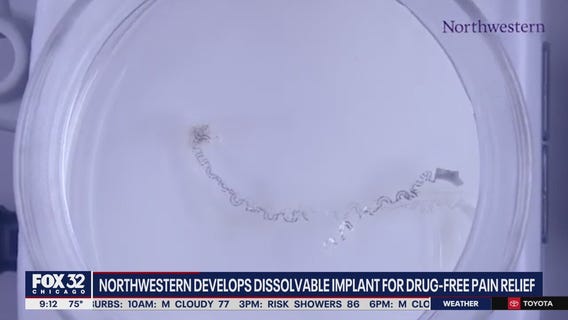 Northwestern researchers develop dissolvable implant for drug-free pain relief post-surgery