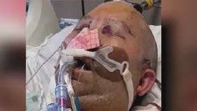 Man, 18, charged in brutal beating, carjacking of Chicago man in Chinatown