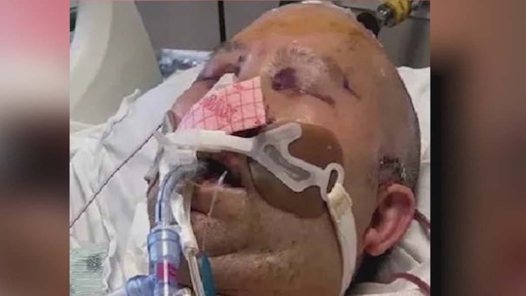 Man, 18, charged in brutal beating, carjacking of Chicago man in Chinatown