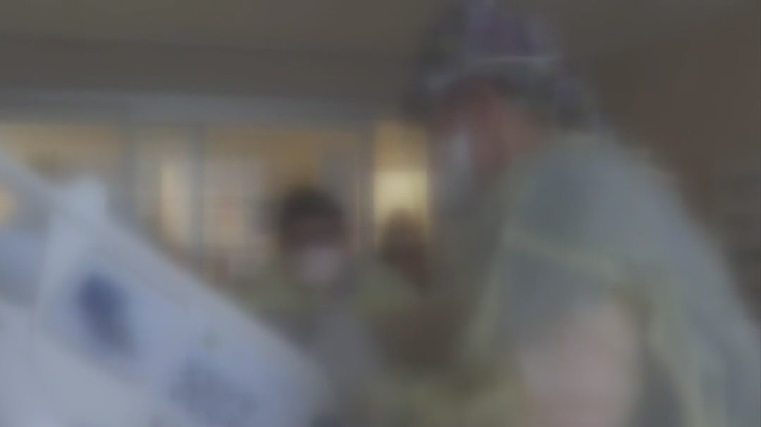 Monkeypox linked to Indiana death