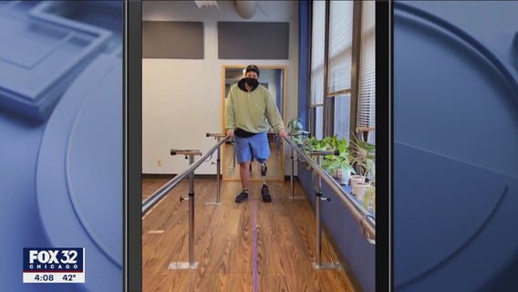 Video shows Dakotah Earley using new prosthetic leg