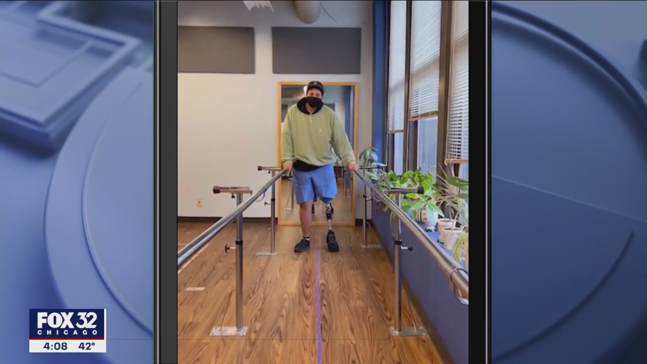 Video shows Dakotah Earley using new prosthetic leg