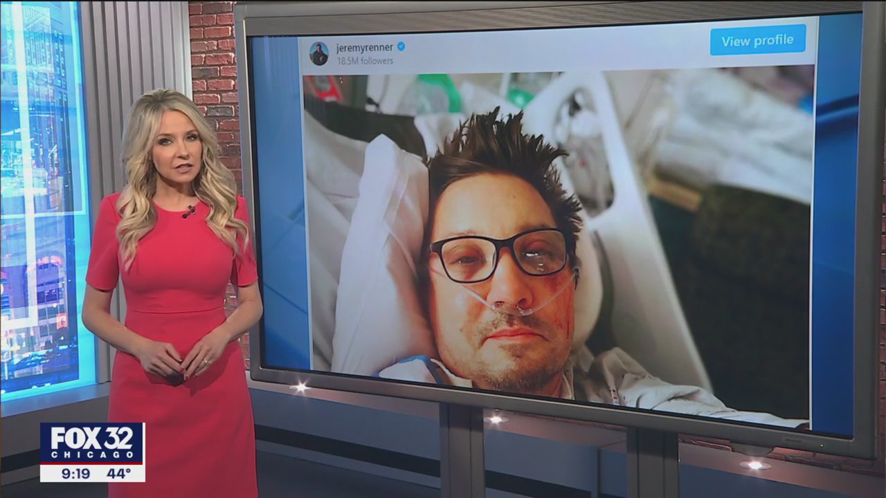 Jeremy Renner shares photo from hospital bed
