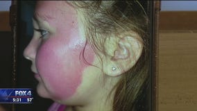 On Your Side: Face Mask Concerns