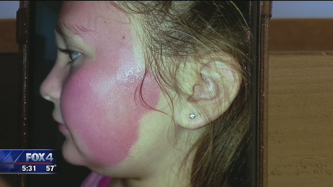 On Your Side: Face Mask Concerns