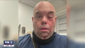 EMT shortage impacting Chicago; lack of pay and violence among causes