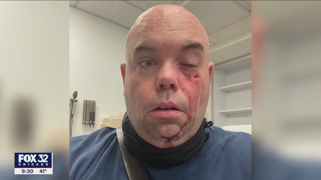 EMT shortage impacting Chicago; lack of pay and violence among causes