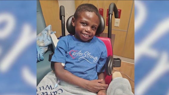 Bolingbrook boy undergoes several heart surgeries to repair congenital heart defect