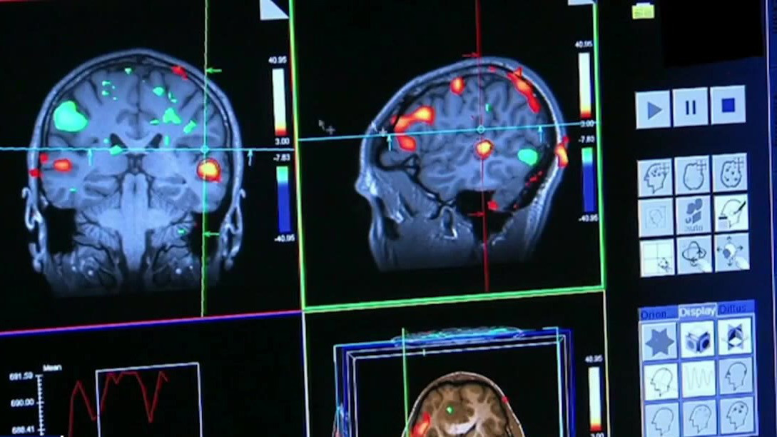 Behind the new Alzheimer's blood test