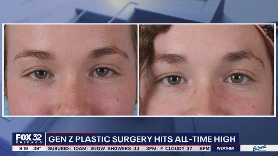 Plastic surgery among younger generation hits all-time high