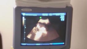 Pritzker supports bill that would impose fines to 'deceptive' crisis pregnancy centers