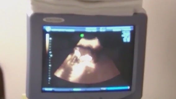 Pritzker supports bill that would impose fines to 'deceptive' crisis pregnancy centers