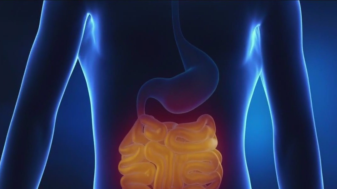 Doctors say people are getting too much niacin from foods