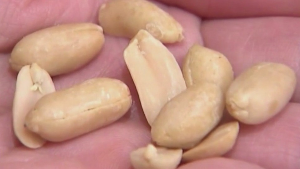 Rising peanut allergy rates in kids prompt exploration of special therapy