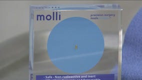 Microchip improves breast cancer surgery, doctors say