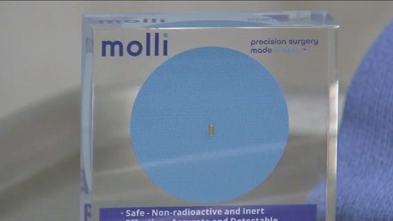 Microchip improves breast cancer surgery, doctors say