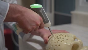 Northwestern Medicine introduces Hubly drill for brain surgery