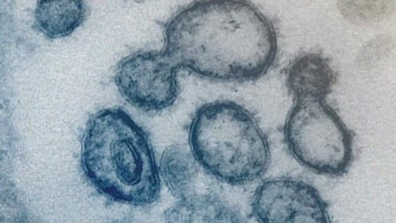 Chicago measles outbreak: Who is at risk? How fast does it spread?