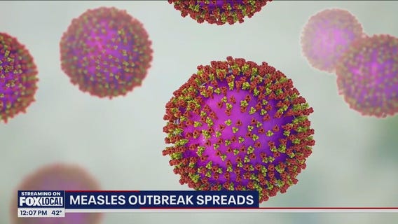 Measles outbreak: More than dozen states reported cases in 2024