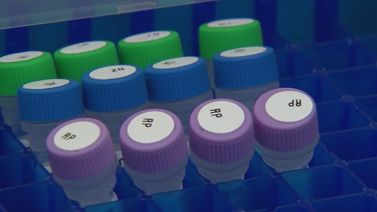 Chicago measles outbreak: Total cases reach 17