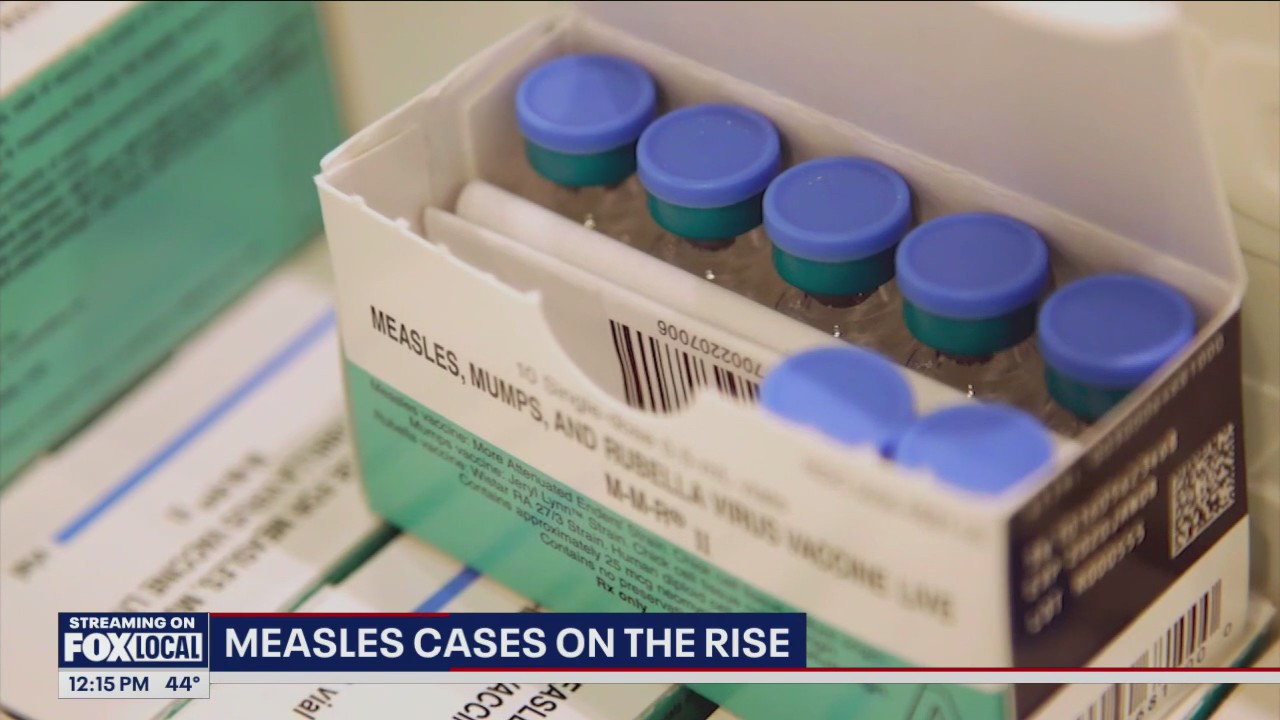 More than half of measles cases reported in US were in Chicago