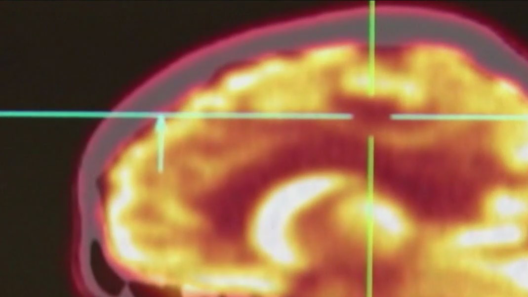 Understanding neurodiversity in the workplace