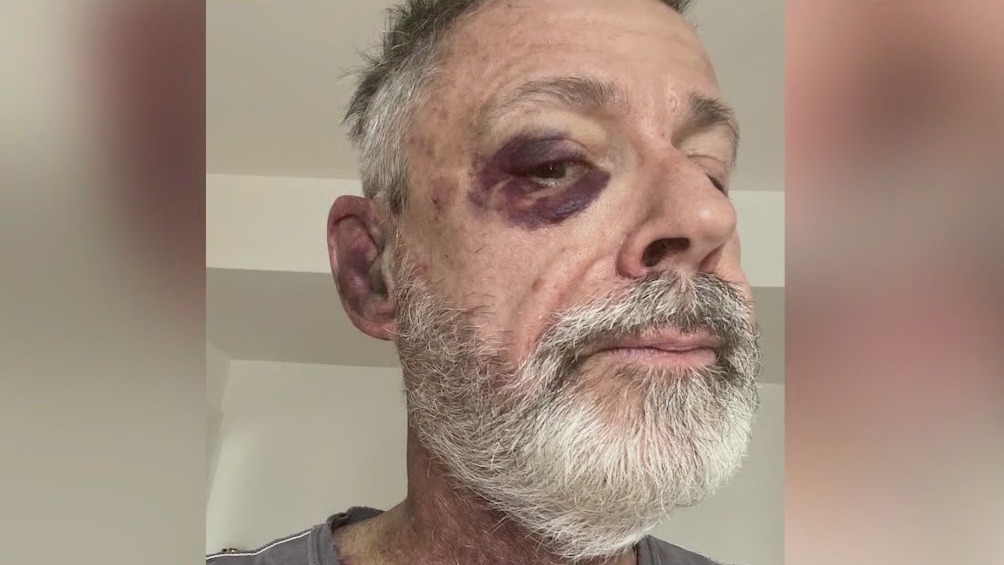 5 juveniles charged in violent robbery on CTA train