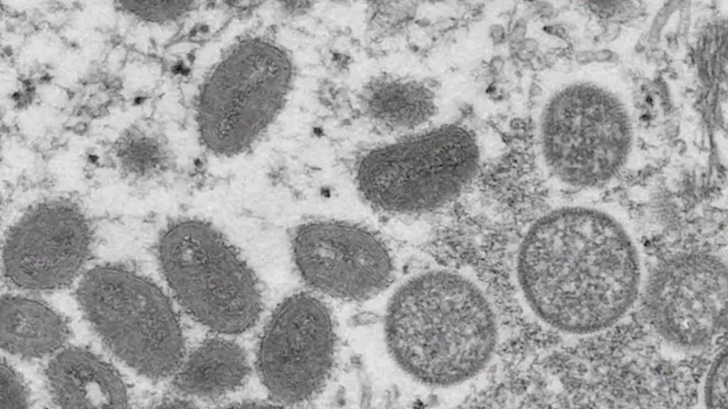 Fast-moving strain of MPox could make its way to the US