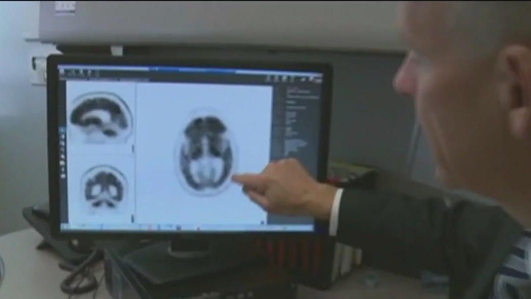 How to keep your brain healthy for the long run