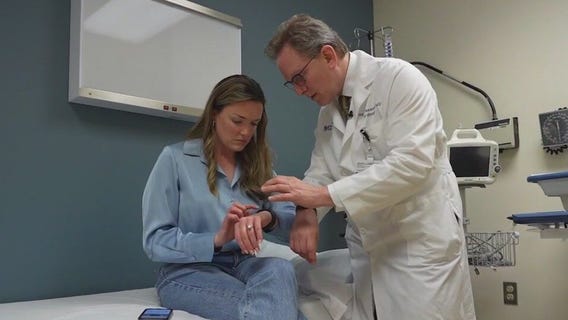 Apple Watch may help a-fib patients avoid blood thinners in Northwestern trial