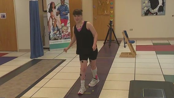 Shriners Children's Chicago lab helps patients with walking