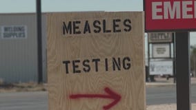 Measles outbreak showing no signs of slowing down