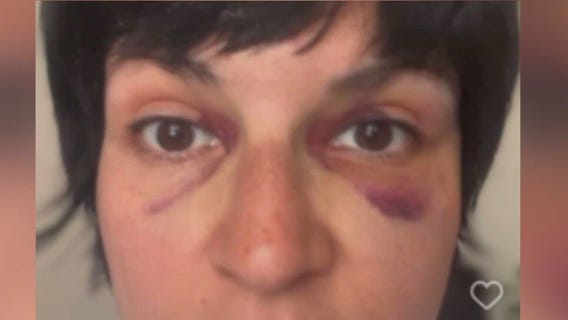 After violent attack at Chicago mural, calls for hate crime charges