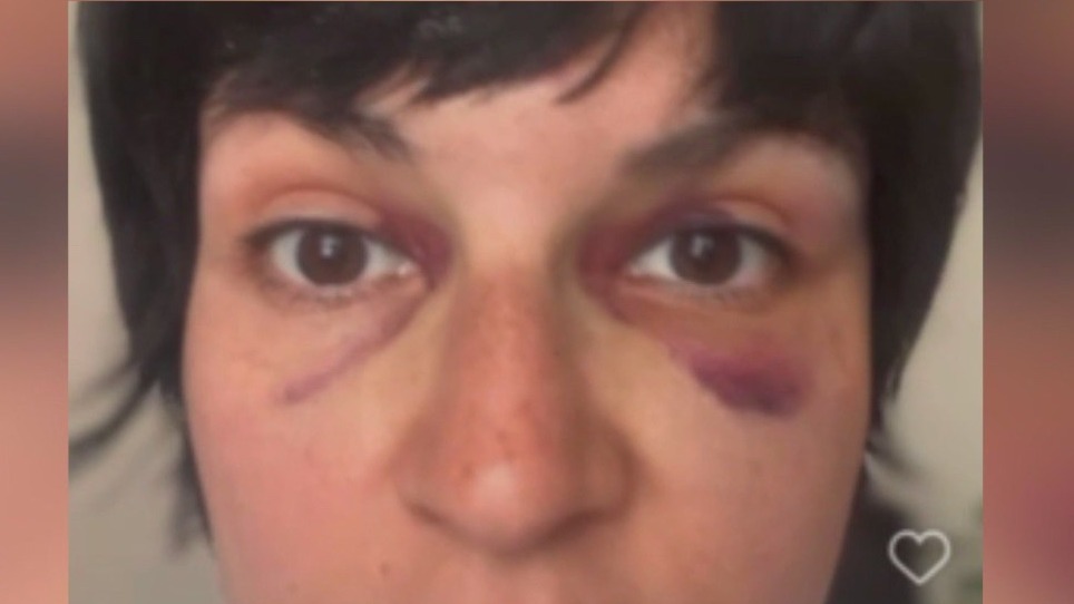 After violent attack at Chicago mural, calls for hate crime charges