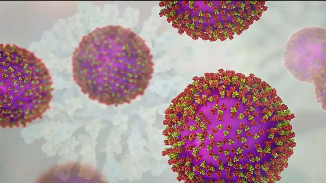 Rockland County issues measles warning