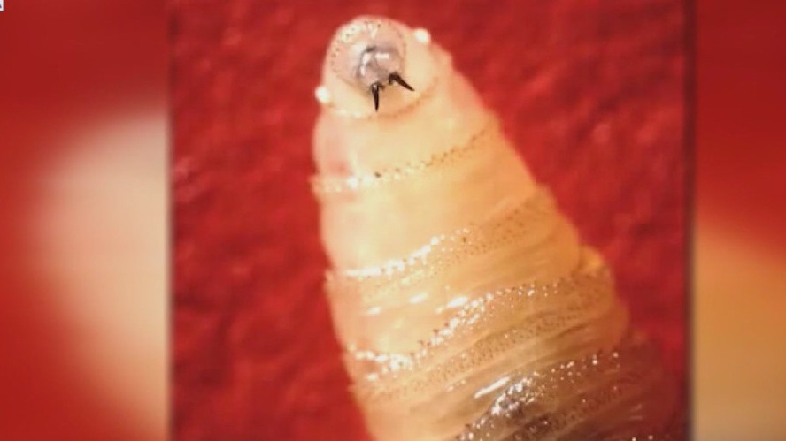 First U.S. case of flesh-eating parasite confirmed