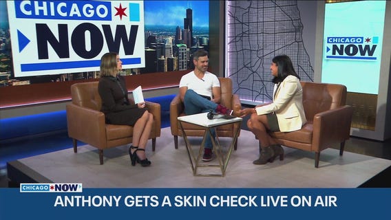 Dermatologist explains what to keep an eye out for | ChicagoNOW
