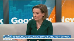 Dr. Susannah Hills on measles and tuberculosis: Good Day Today