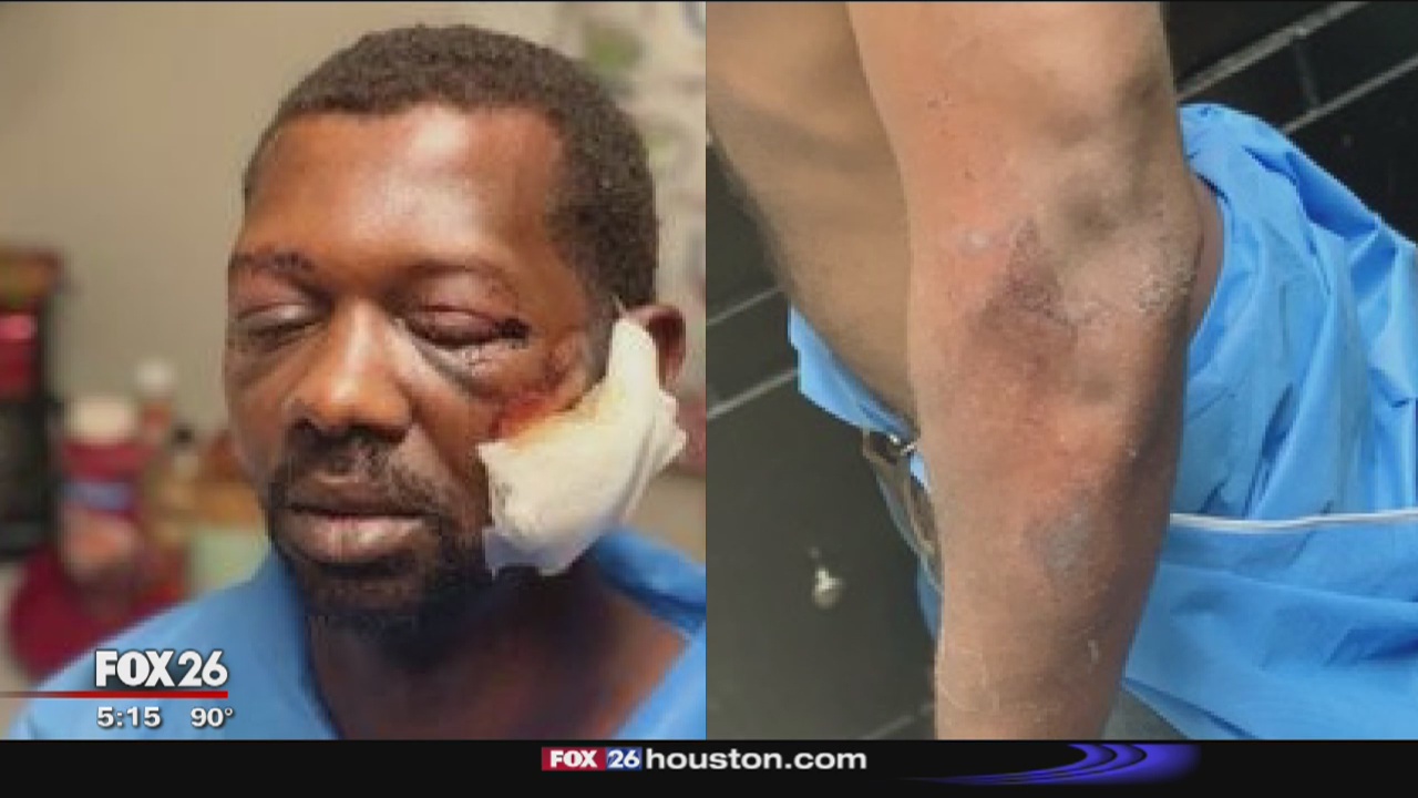 Man beaten by Baytown police officers because of his race, attorney says