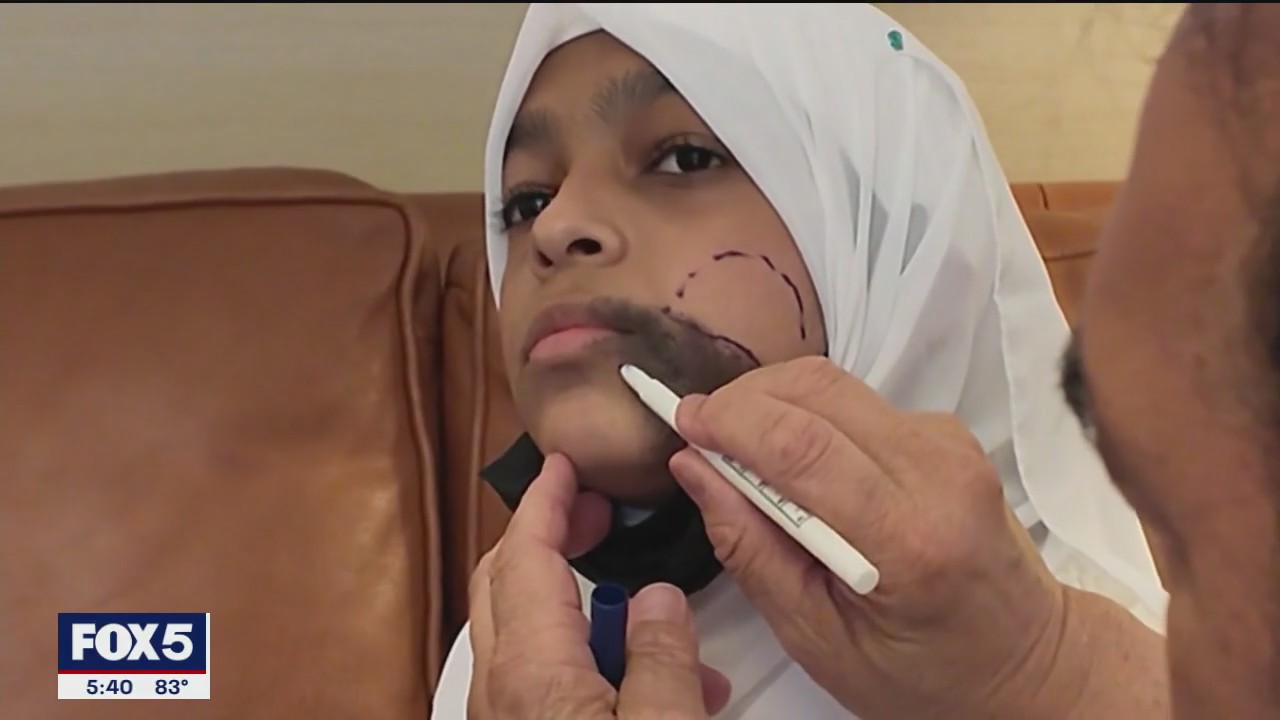 Free facial surgery gives teen a new chance at life