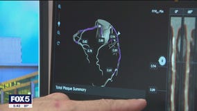 Using A.I. to detect heart disease