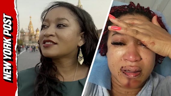Black woman in Russia beaten by racist neighbors