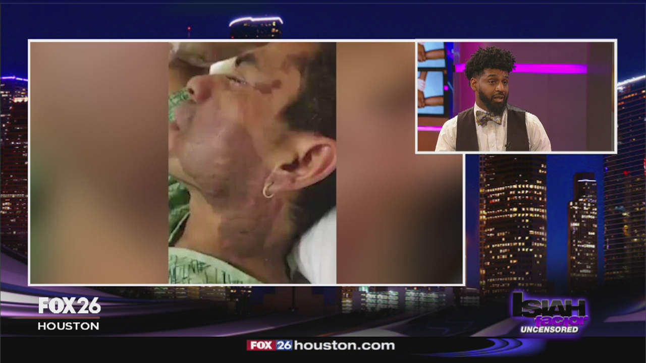 EXPOSING HATE: How hate crimes cause trauma