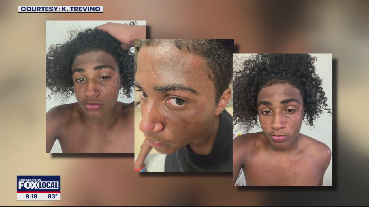 Texas student attacked on school bus by adults