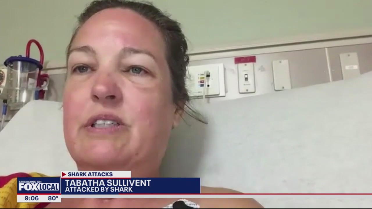 NTX woman bitten by shark on South Padre Island