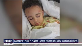 NJ mom questions school after autistic son comes home with bruises