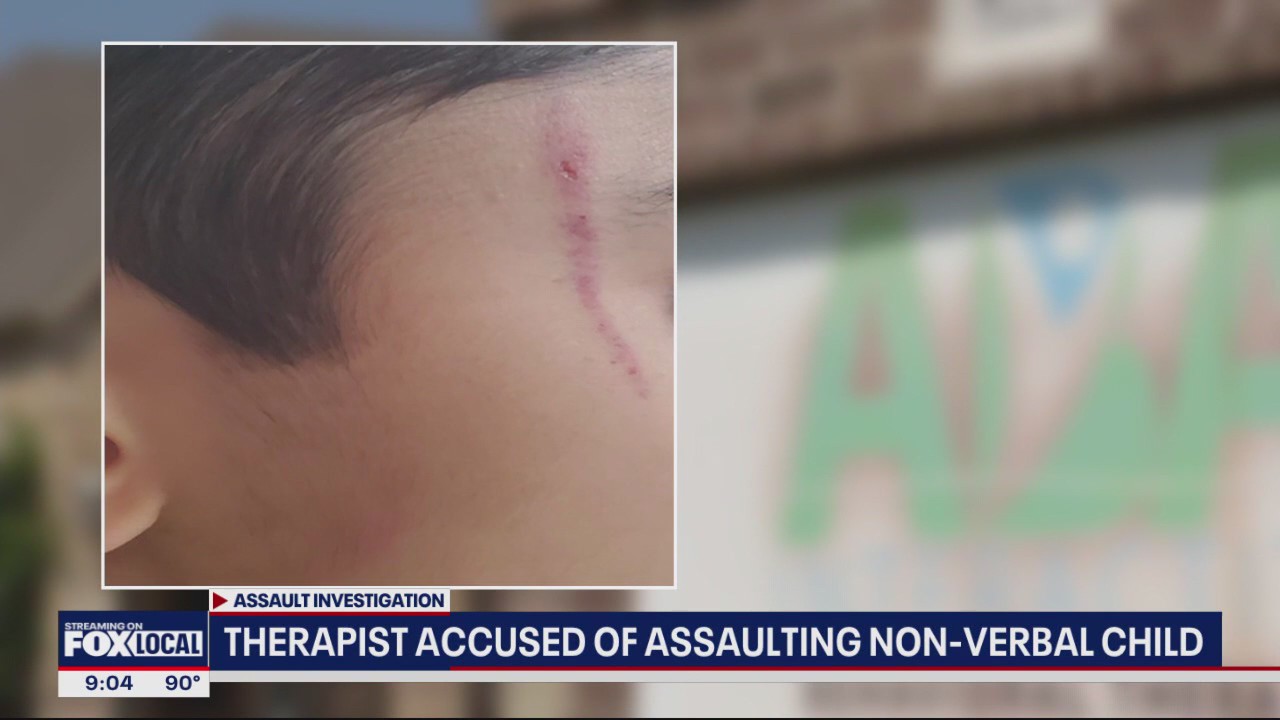 Therapist accused of attacking non-verbal child